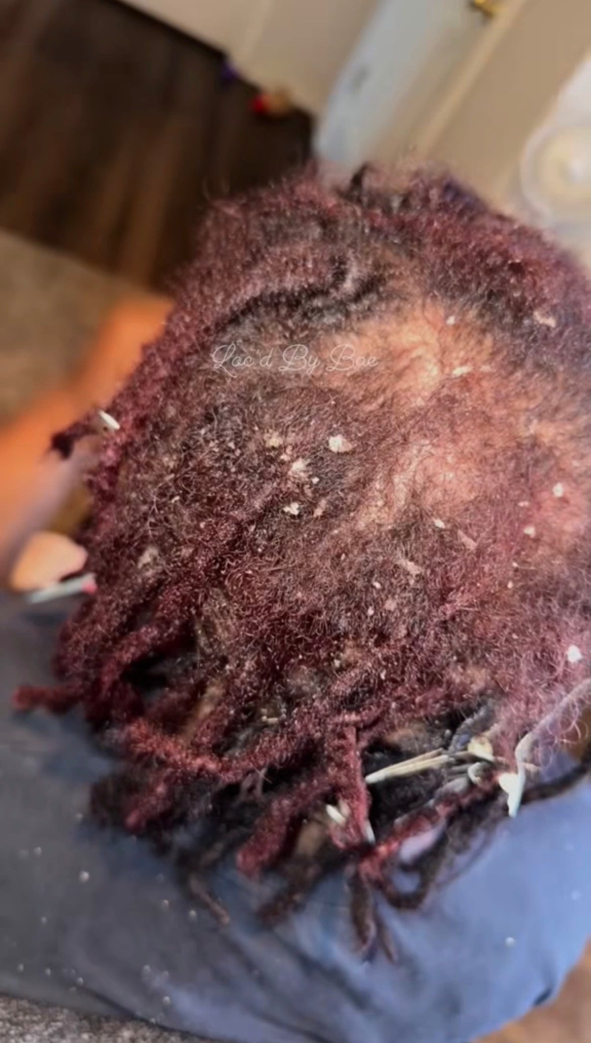 Loc Detox